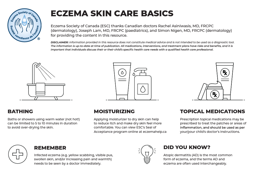 Living With Eczema Eczema Society Of Canada